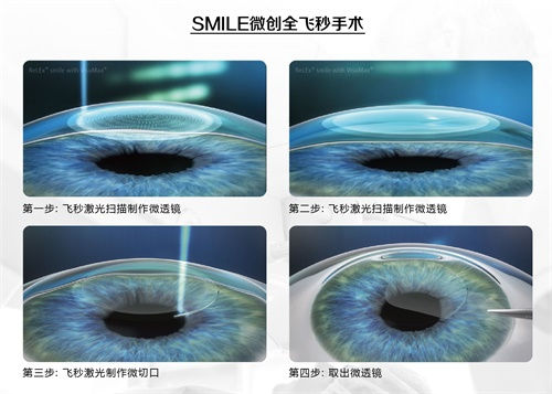 眼科謠言，你的“好心轉(zhuǎn)載”辦了多少壞事