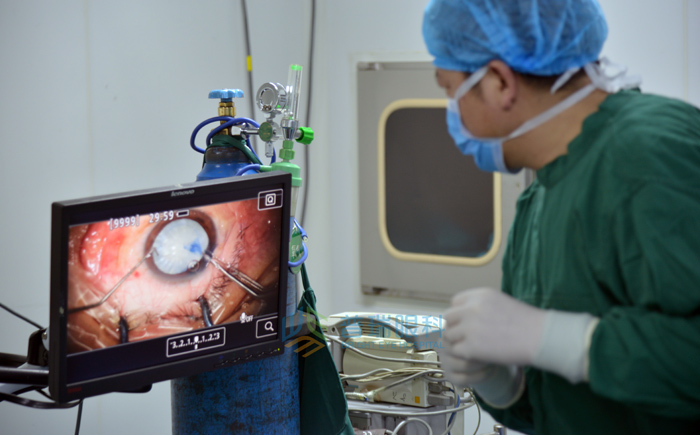 詳解白內(nèi)障到底會不會傳染？